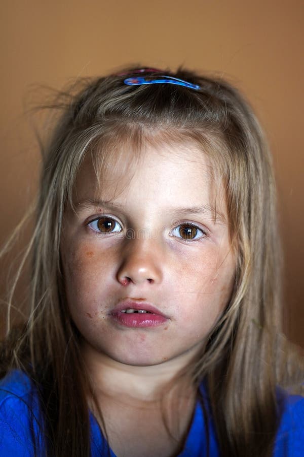 Portret dziewczyny z zepsutymi zębami i twarz wymazana czekoladą. niezdrowa dieta szkodzi cukrem dla dzieci. fotografia royalty free
