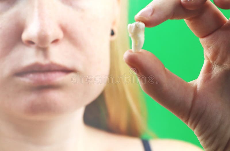 Posa confusa di una donna con mal di denti e di una mano che tiene il dente estratto, hocus sulla mano immagine stock libera da diritti Posa confusa di una donna con mal di denti e di una mano che tiene il dente estratto, hocus sulla mano immagine stock libera da diritti