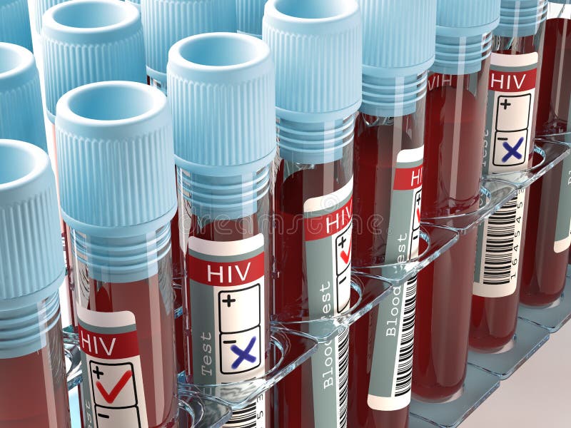 Positief en negatief HIV stock afbeelding Positief en negatief HIV stock afbeelding