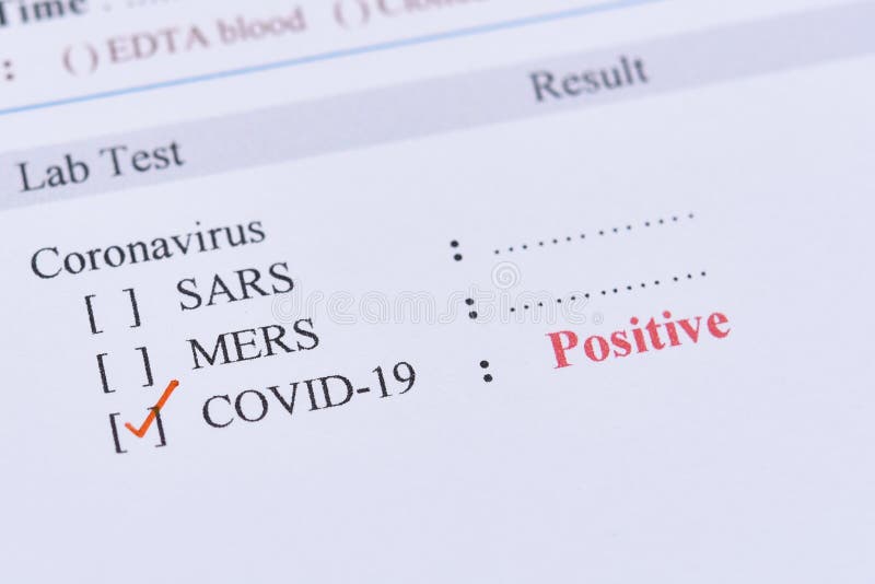 Positive Test Result Of Covid 19 Stock Photo Image Of Disease