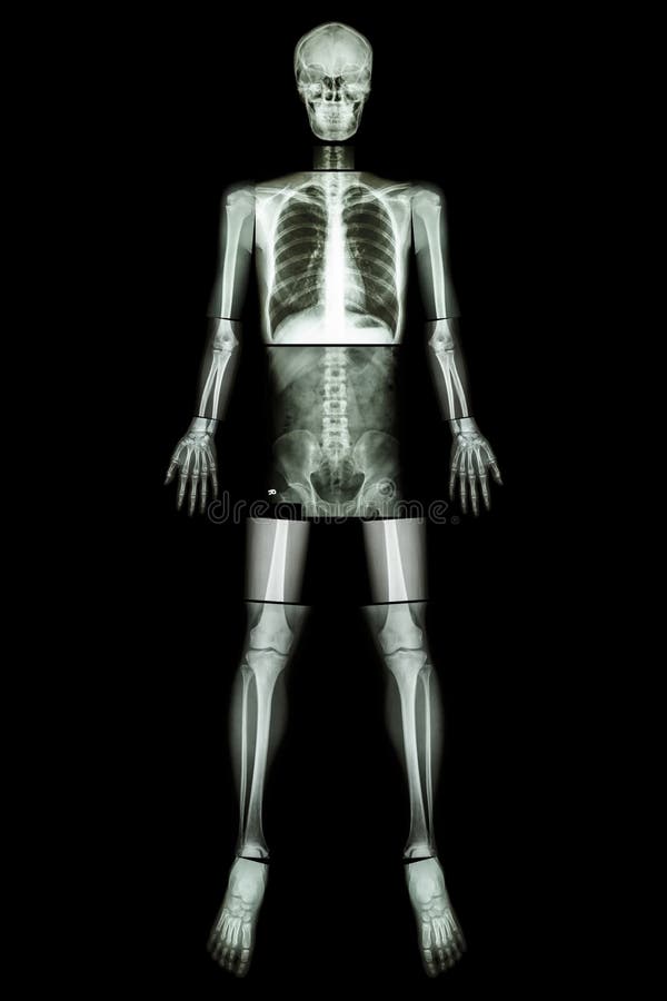 Posizione anatomica (Corpo intero dei raggi x)