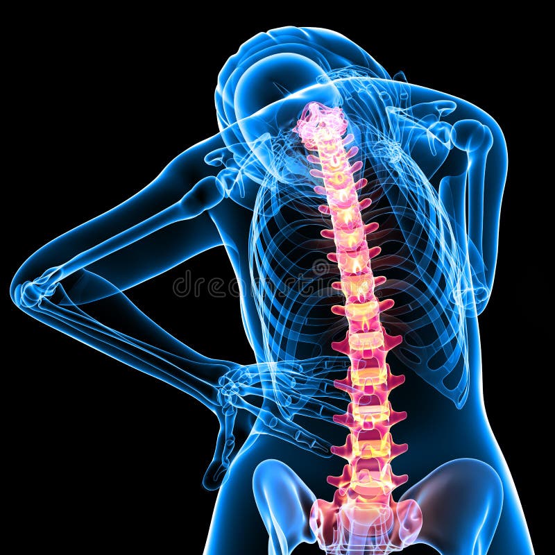 Posterior View Of Female Skeleton With Back Pain Stock Illustration
