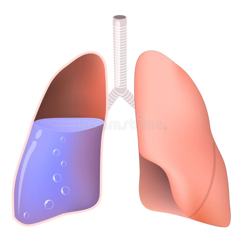 Poumons avec de l'eau illustration de vecteur. Illustration du santé