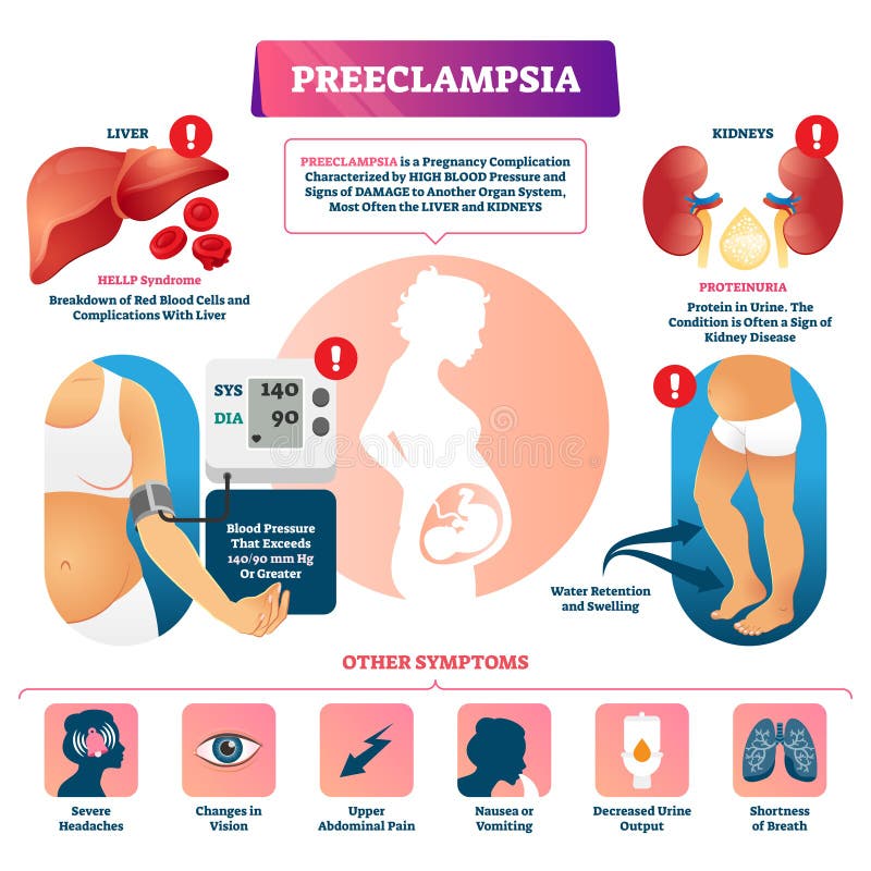 pregnancy disease eclampsia