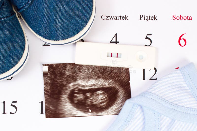 Pregnancy test, ultrasound scan of baby and clothing for newborn on calendar, expecting for baby stock images