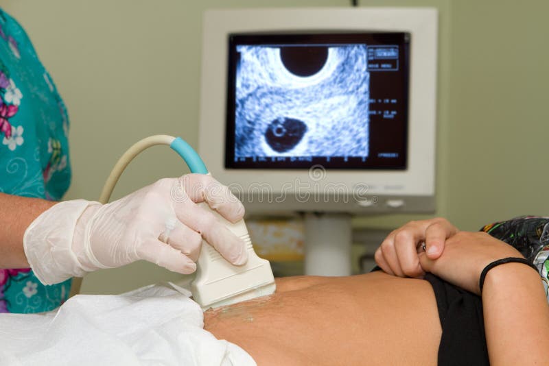 Ecografista tecnico contiene un trasduttore ad ultrasuoni per diagnosticare la condizione di una donna incinta con una vista womans utero sullo schermo del computer.