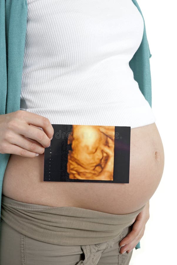 Pregnant woman holding scan