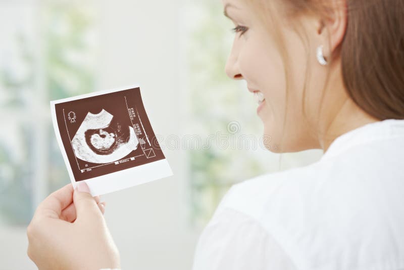 Pregnant woman holding sonogram