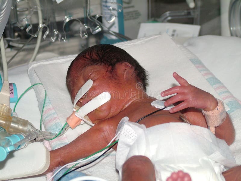 Premature Baby in Hospital