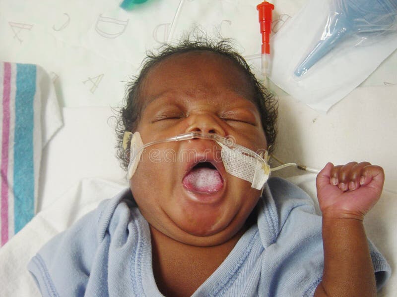 Premature Baby Taking A Yawn royalty free stock photography