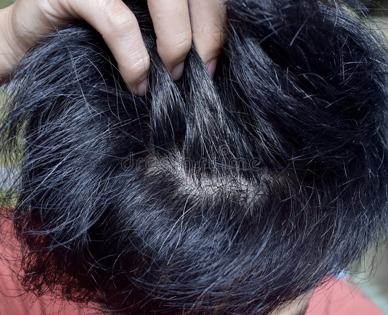 Prematurely Gray Hair. Southeast Asian Young Man Showing His Early Grey Hair  Stock Photo - Image of premature, asian: 183025488