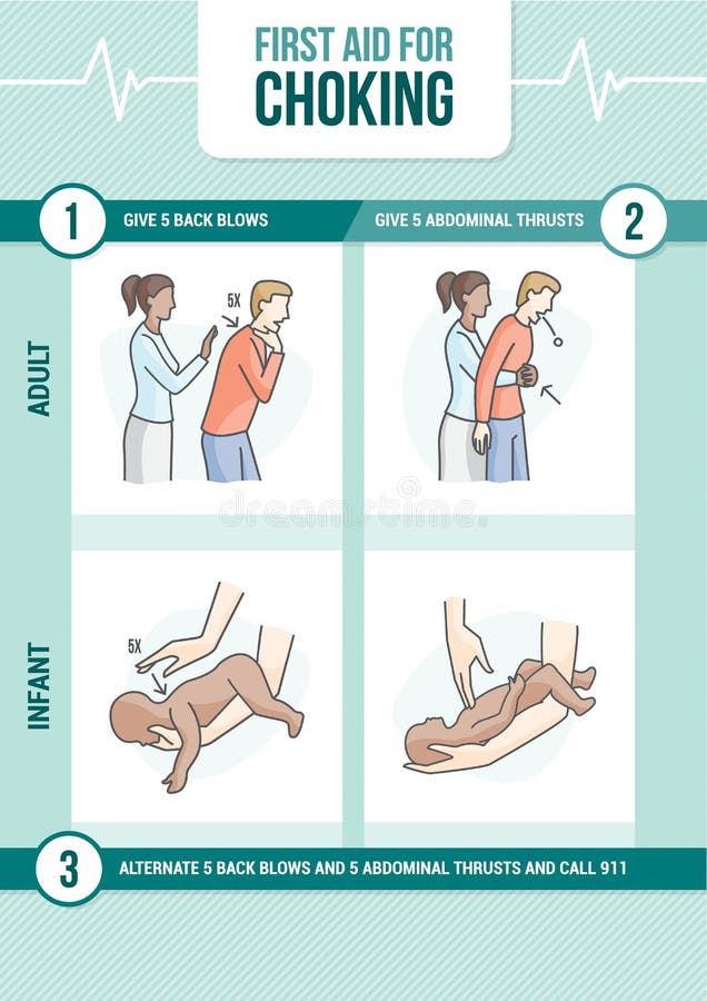 Premiers secours d'obstruction illustration stock Premiers secours d'obstruction illustration stock