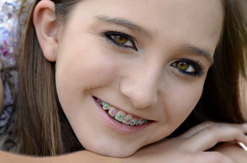 Pretty Teen With Braces Stock Image Image Of Cute Confide
