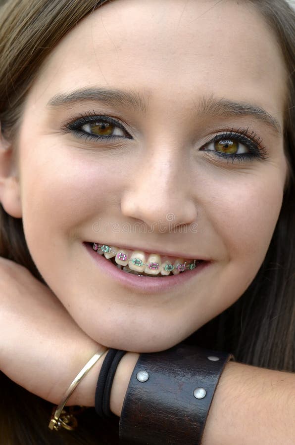 Pretty Teenager with Braces