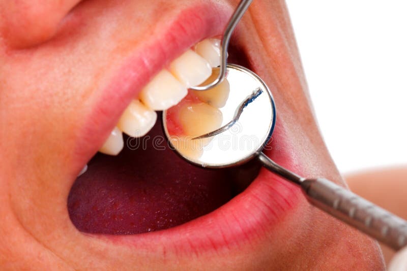 Primo piano di funzionamento del dentista Primo piano di funzionamento del dentista