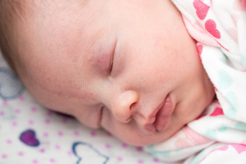 Closeup of a newborn baby sleeping in the crib, stork bite on forehead and eyelid. Closeup of a newborn baby sleeping in the crib, stork bite on forehead and eyelid