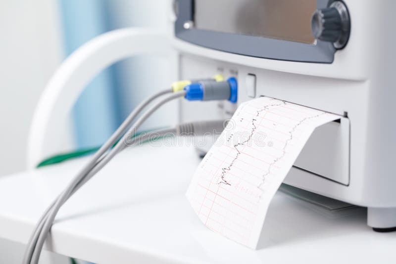 Primo piano fetale d'esecuzione fetale elettronico di battito cardiaco del monitoraggio del monitor EFM Cardiotocography CTG