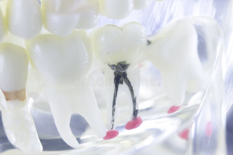 Principale canale dentario del dente