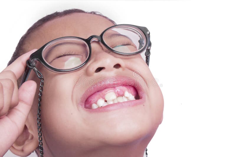 Pringsewu, Lampung October 10, 2022 boy in glasses with open mouth with missing front teeth isolated whit stock image