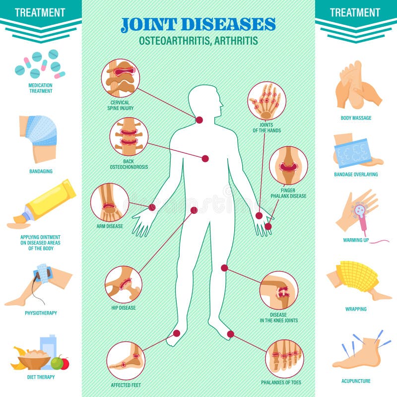 Probl?me d'?pine Douleur des maladies de joints Arthrite, symptômes d'ostéoarthrite, traitement de médicament illustration de vecteur Probl?me d'?pine Douleur des maladies de joints Arthrite, symptômes d'ostéoarthrite, traitement de médicament illustration de vecteur