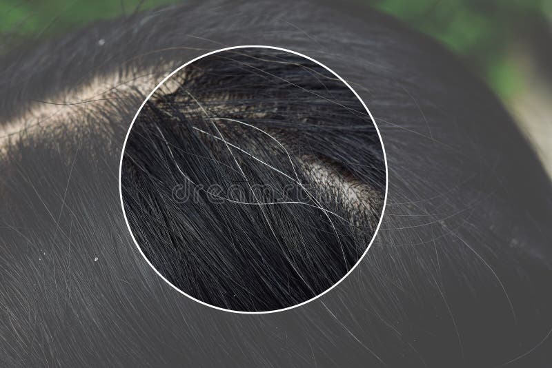 Problemas de saúde do cabelo e do escalpe, mulher asiática nova com primeiro cabelo cinzento imagem de stock Problemas de saúde do cabelo e do escalpe, mulher asiática nova com primeiro cabelo cinzento imagem de stock