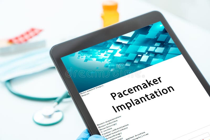 Pacemaker Implantation medical procedures A procedure that involves implanting a device in the chest to help regulate the heartbeat. Pacemaker Implantation medical procedures A procedure that involves implanting a device in the chest to help regulate the heartbeat