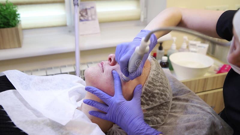 Procedura Microdermabrasion zbiory wideo