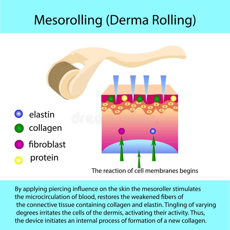 Proceso de Mesorolling con una estructura del describtion y de célula stock de ilustración Proceso de Mesorolling con una estructura del describtion y de célula stock de ilustración