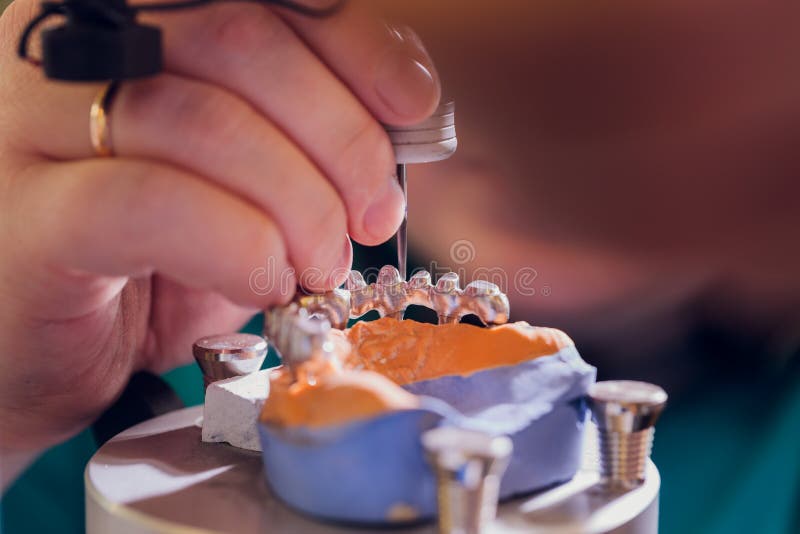 The Process of Making a Dental Prosthesis in a Dental Laboratory. Stock