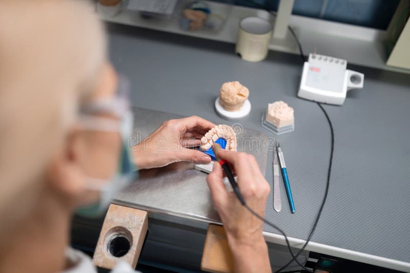 Process of Making Porcelain Veneers in Dental Clinic. Stock Image