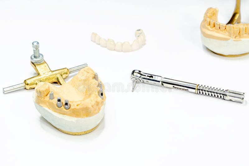 The Process of Manufacturing Ceramic Teeth on Implants. Dental Implants