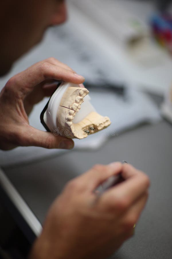 The Process of Manufacturing Dentures Stock Image Image of blurred, tooth 100185541