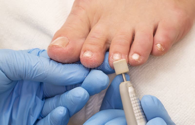 Process of pedicure stock image. Image of health, doctor 44623629