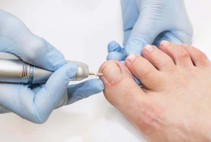 Process of pedicure stock image. Image of care, chiropody - 64368773