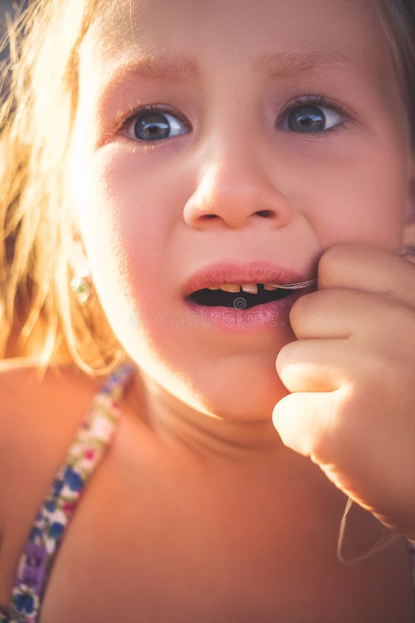 The Process of Removing a Baby Tooth Using a Thread Stock Photo Image
