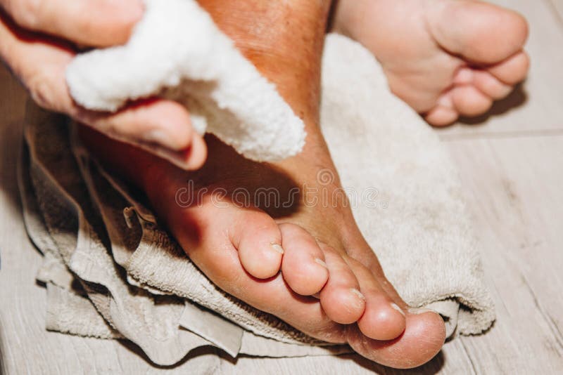 The Process of Treating a Leg Injury at Home. Scar after Surgery. Bone