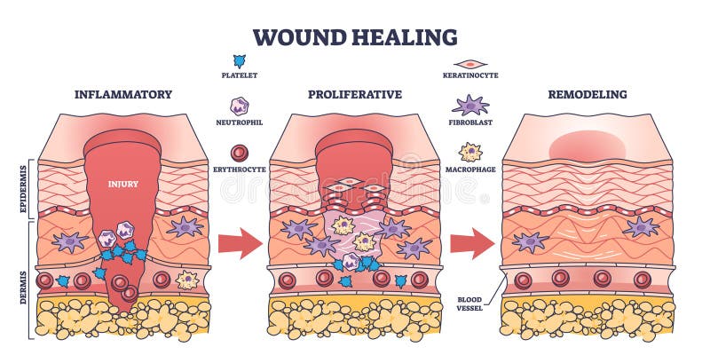 Process of Wound Healing and Anatomical Body Injury Repair Outline Biology Diagrams