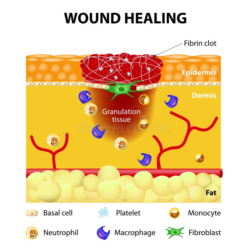 Process Of Wound Healing Stock Vector  Illustration Of