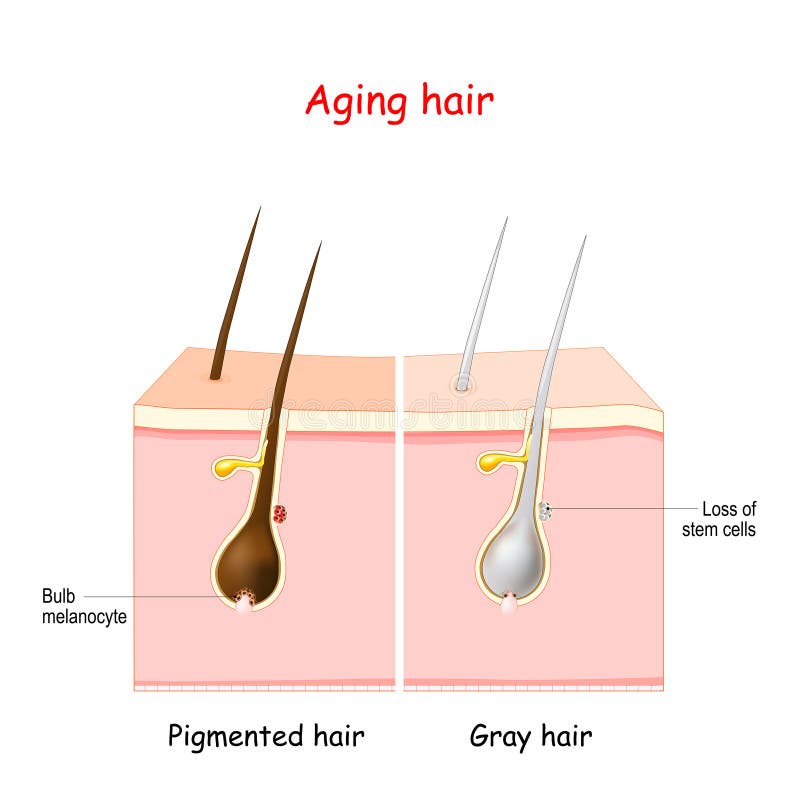 Processo di invecchiamento per capelli grigi. peli pigmentati e grigi