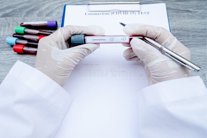 Professional Doctors Perform COVID19 Tests from Samples of Blood Tests