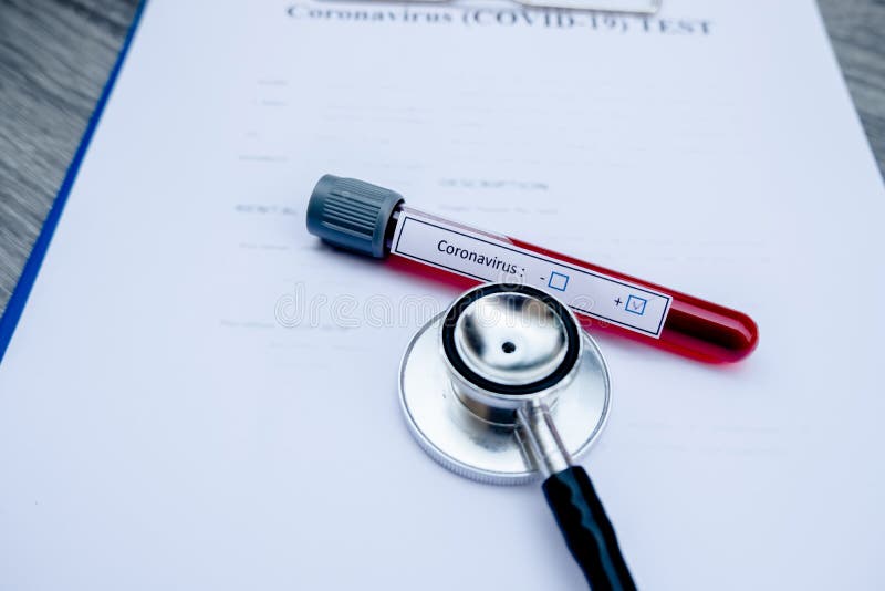 Professional Doctors Perform COVID19 Tests from Samples of Blood Tests