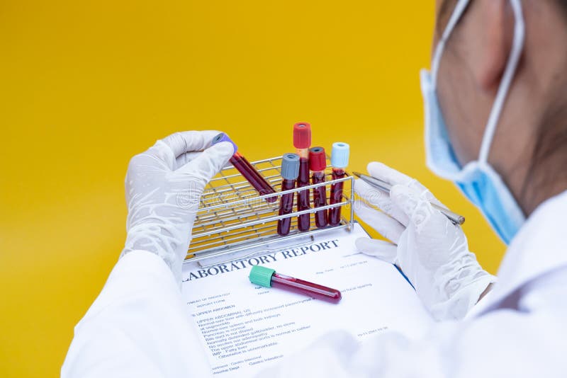 Professional Doctors Perform COVID19 Tests from Samples of Blood Tests