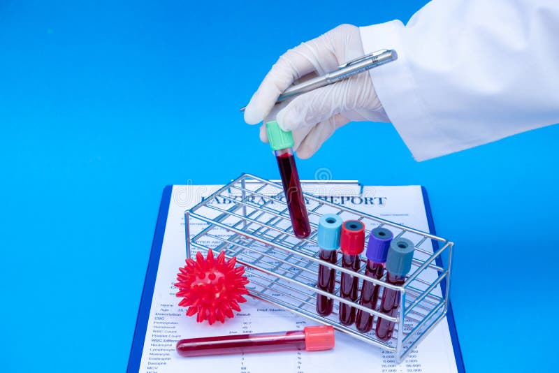 Professional Doctors Perform COVID19 Tests from Samples of Blood Tests