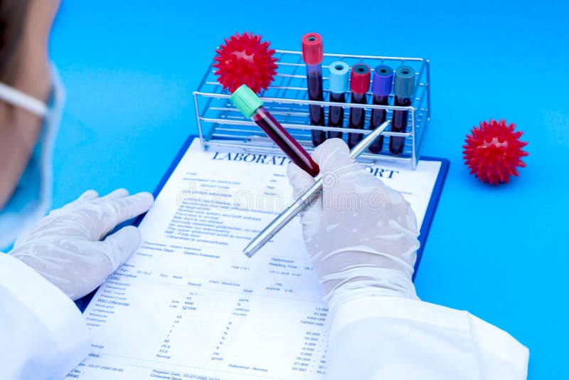 Professional Doctors Perform COVID19 Tests from Samples of Blood Tests