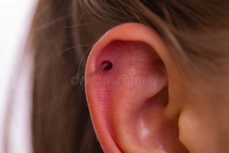 124 Child Ear Piercing Photos Free Royalty Free Stock Photos From Dreamstime