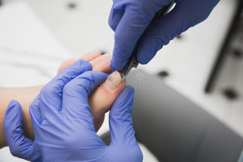 Professional pedicure using dieffenbach scalpel. Medical pedicure procedure  using special instrument. Treatment of calluses and skin fungus. Beauty &  Fashion Stock Photos