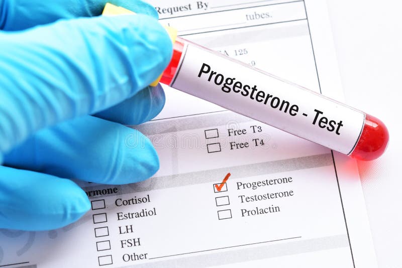 Progesterone hormone test stock image. Image of medicine 116270521