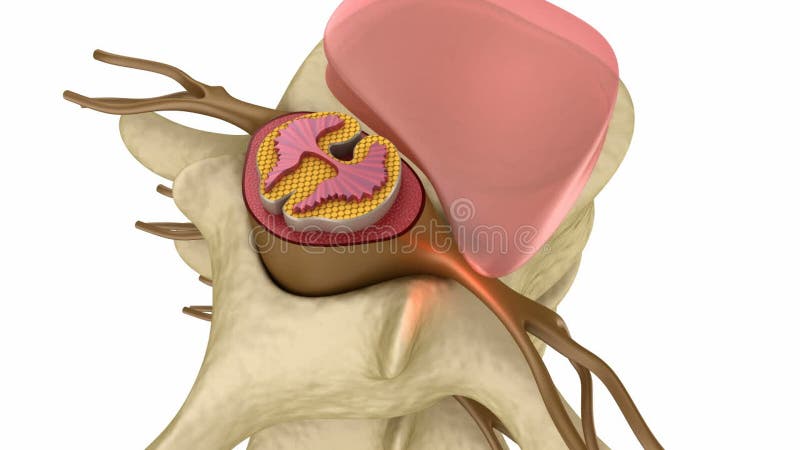 Prolaps du disque intervertébral illustration stock