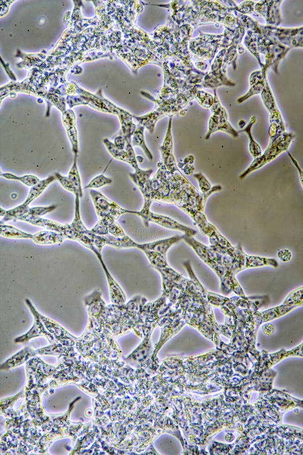 Prostate Cancer cells