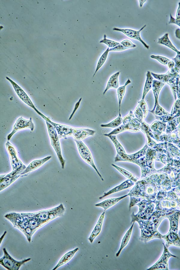 Prostate Cancer cells